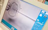 Study Finds No Increased Risk of CVD Years After Infertility Therapies