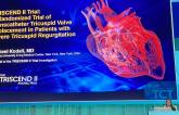 ‘Big Step Forward’ for Transcatheter Tricuspid Valve Replacement: TRISCEND II