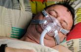 Adherence Key to CPAP’s Benefits in Sleep Apnea Patients With CVD