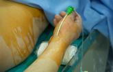 Radial Access Is Safe, Effective for Peripheral Interventions: R2P Registry