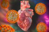 Small Study Hints at Mechanism for COVID-Related MI and Stroke