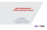 Mitral Regurgitation TMVR is the way Forward
