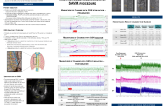 Hemodynamic Response Related to Stimulation of the Greater Splanchnic Nerve Pre- and Post- Ablation