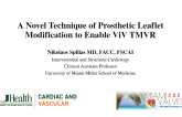 A Novel Technique of Prosthetic Leaflet Modification to Enable ViV TMVR