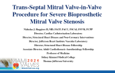 Trans-Septal Mitral Valve-in-Valve Procedure for Severe Bioprosthetic Mitral Valve Stenosis
