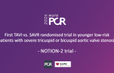 First TAVI vs. SAVR randomised trial in younger low-risk patients with severe tricuspid or bicuspid aortic valve stenosis - results from NOTION-2
