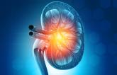 Study Supports Cost-effectiveness of Renal Denervation for Hypertension