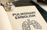 Different Guidelines for Acute PE Offer a Mixed Bag of Advice