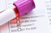 High-Sensitivity Troponin Assays Not All the Same, APACE Data Confirm
