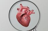 CMR May Improve Assessment of ICD Need in Cardiac Sarcoidosis