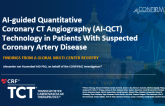 Artificial-Intelligence Enabled Quantitative CT Assessment of Atherosclerosis and Major Adverse Events: The Multi-Center International CONFIRM2 Registry