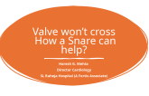 Valve won’t cross: How a Snare can help?