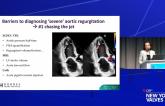 Rethinking Aortic Regurgitation in 2026: Gaps, Guidelines, and Innovation