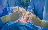 Outcomes Steady as Hearts Donated After Circulatory Death Rise in the US