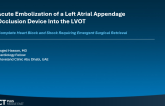 Acute Embolization of a Left Atrial Appendage​ Occlusion Device Into the LVOT​