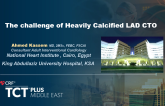 The challenge of Heavily Calcified LAD CTO