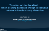 To stent or not to stent: When a cutting balloon is enough in occlusive catheter induced coronary dissection