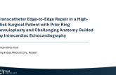 Transcatheter Edge-to-Edge Repair in a High-Risk Surgical Patient with Prior Ring Annuloplasty and Challenging Anatomy Guided by Intracardiac Echocardiography​