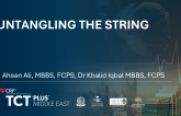 Untangling the String