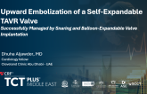 Upward Embolization of a Self-Expandable TAVR Valve: Successfully Managed by Snaring and Balloon-Expandable Valve Implantation​
