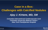 Case in a Box: Challenges with Calcified Nodules