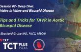 Lifetime Management: What to Consider When Deciding Between TAVI and SAVR?