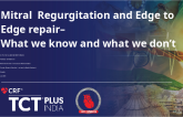 Mitral Regurgitation and Edge to Edge repair – What we know and what we don’t