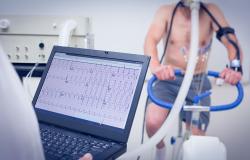 Stress Testing Picks Up ‘Novel Risk Patterns’ in Stable CAD Patients: ISCHEMIA