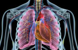 Mechanical Thrombectomy Outshines Anticoagulation Alone in STORM-PE