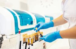 Patient Age Adds Key Context to D-Dimer in DVT Diagnosis: ADJUST-DVT