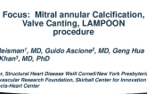 Anatomical Measurements for Sizing the MV Orifice and Relational Anatomy/Valve Canting, LVOTO with Discussion