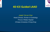 4D ICE Guided LAAO in Hong Kong