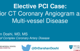 Elective PCI Case: Prior CTA With High Calcium Score and MVD