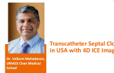 Transcatheter Septal Closure in USA with 4D ICE Imaging