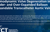 TCT 825: Hemodynamic Valve Deterioration in Under- vs Over-Expanded Balloon Expandable Transcatheter Aortic Valves