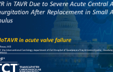 TCT 1323: Case Report of TAVI in TAVI Due to Severe Acute Central Aortic Regurgitation After Transcatheter Aortic Valve Replacement in Small Aortic Annulus With Balloon Expandable Valve