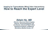 Imaging for Transcatheter Mitral Valve Interventions: How to Reach the Expert Level?