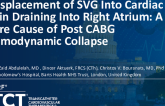 TCT 1588: Misplacement of SVG to PDA Graft Into Cardiac Vein Draining Into Right Ventricle: A Rare Cause of Post CABG Hemodynamic Collapse
