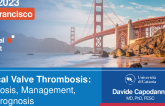 Clinical Valve Thrombosis: Diagnosis, Management, and Prognosis