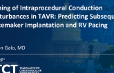 TCT 124: Timing of Intraprocedural Conduction Disturbances in TAVR: Predicting Subsequent Pacemaker Implantation and RV Pacing