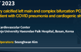 TCT 994: Heavy Calcified Left Main and Complex Bifurcation PCI in Patient With COVID Pneumonia And Cardiogenic Shock