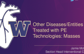 Other Diseases/Entities Treated With PE-Related Technologies: Masses