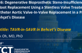 TCT 1236: Degenerative Bioprosthetic Steno-Insufficiency After Aortic Root Replacement Using a Stentless Valve Treated by Transcatheter Aortic Valve-In-Valve Replacement in a Patient With Behçet's Disease 