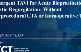 TCT 1100: Emergent TAVI for Acute Bioprosthetic Aortic Regurgitation Without Preprocedural Computed Tomography Angiography or Intraoperative Transesophageal Echocardiography