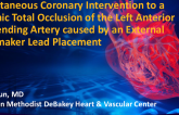 TCT 857: Percutaneous Coronary Intervention for a Chronic Total Occlusion of the Left Anterior Descending Artery caused by an External Pacemaker Lead Placement 