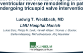 TCT 311: Impact of residual tricuspid regurgitation on right ventricular reverse remodeling in patients undergoing tricuspid valve intervention