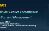 Subclinical Leaflet Thrombosis: Detection and Management