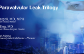 The Paravalvular Leak Trilogy