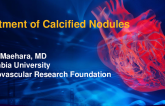 Treatment of Calcified Nodules