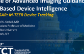 Role of Advanced Imaging Guidance by AI-Based Device Intelligence